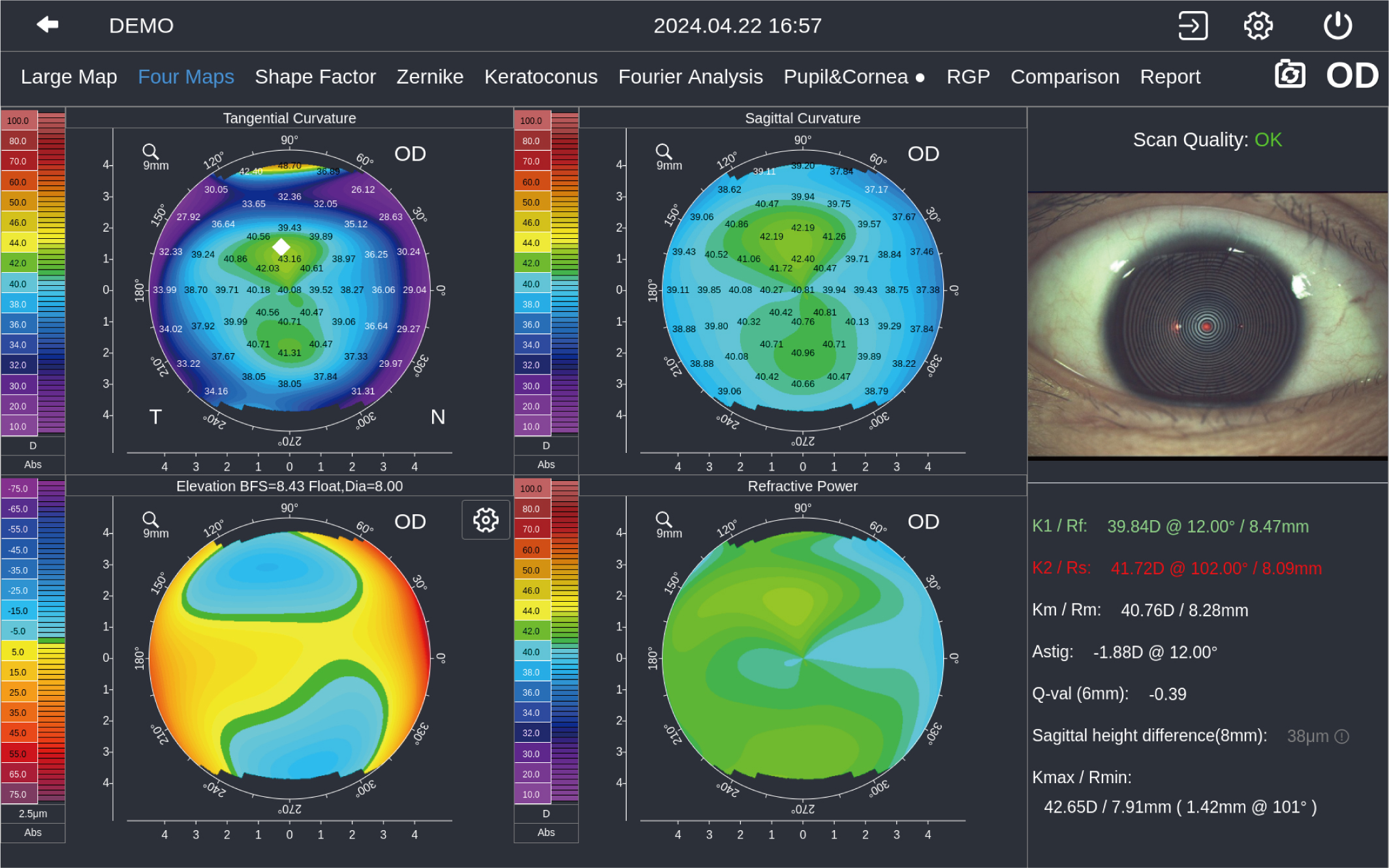 Corneal Topographer DEA520_20240718-13.jpg